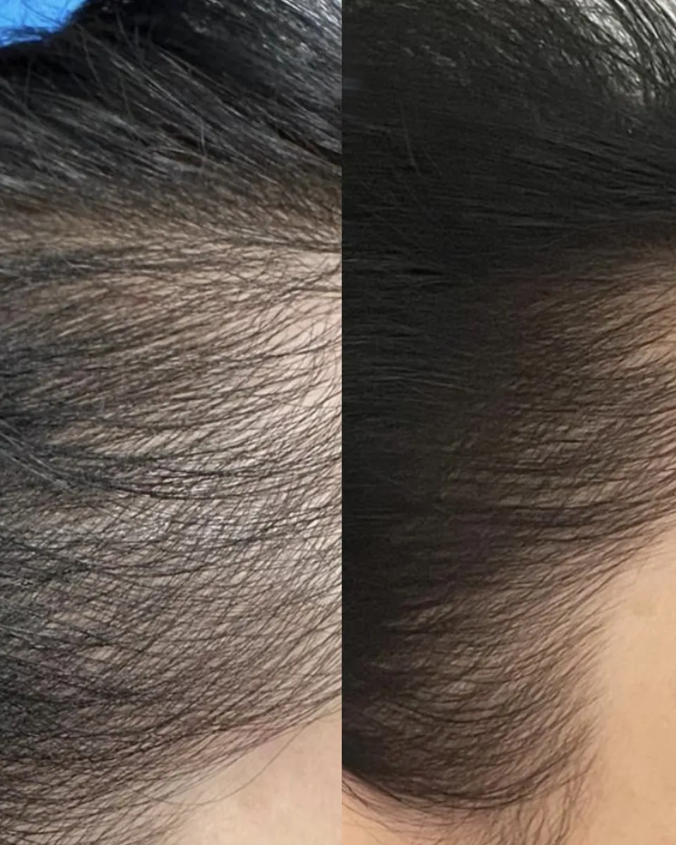 Hair before and after the hair protocol