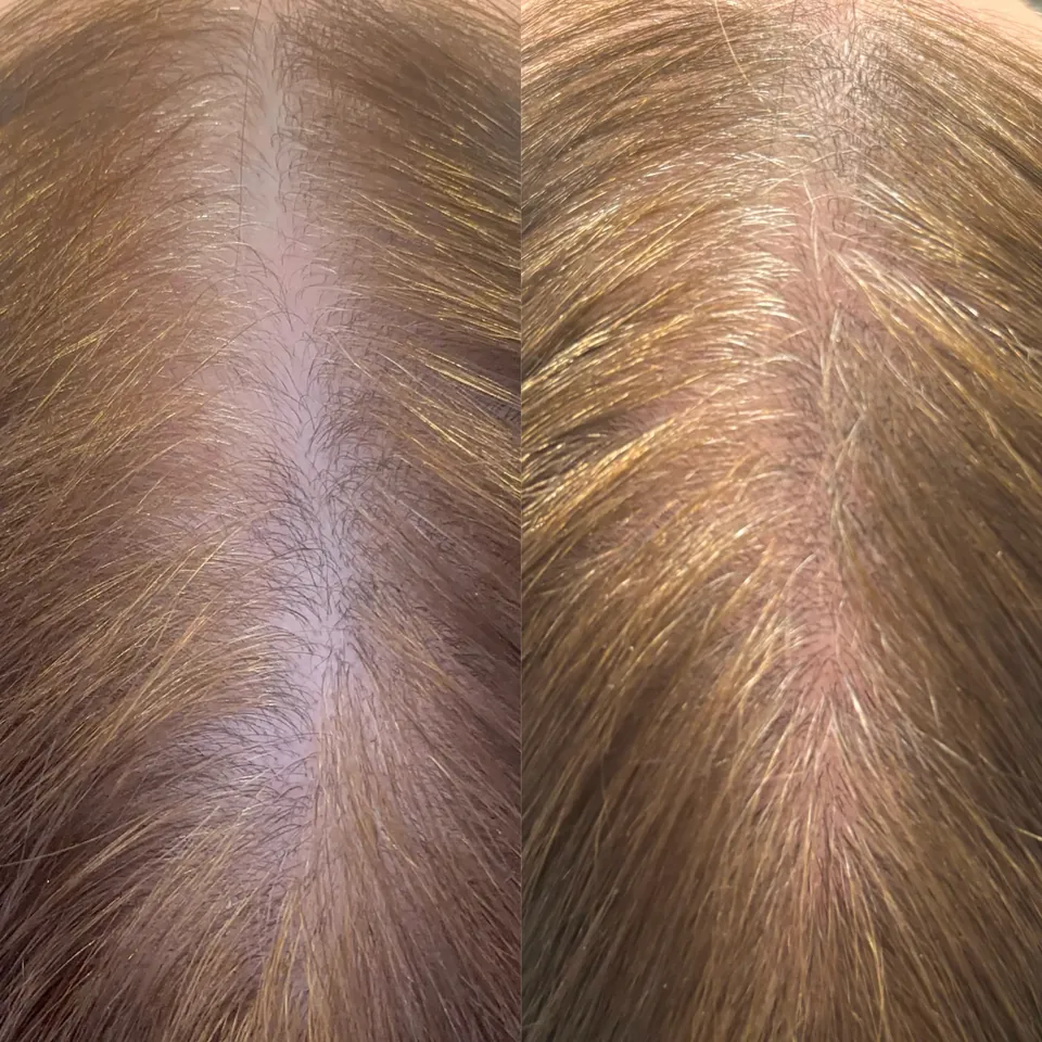 Hair before and after six weeks of the hair protocol