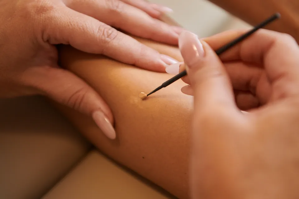 Close-up of a treatment on a client's arm